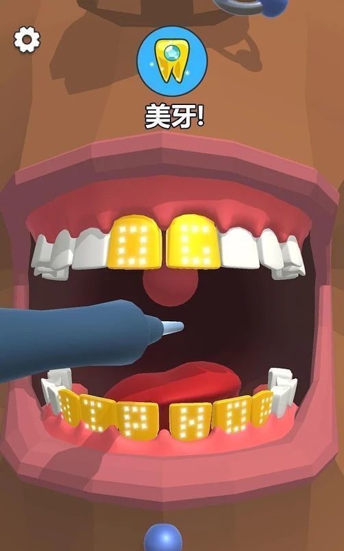 拔牙游戏攻略 VS cago游戏攻略 拔牙游戏攻略 VS cago游戏攻略